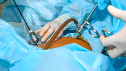Gynaecologic Surgery